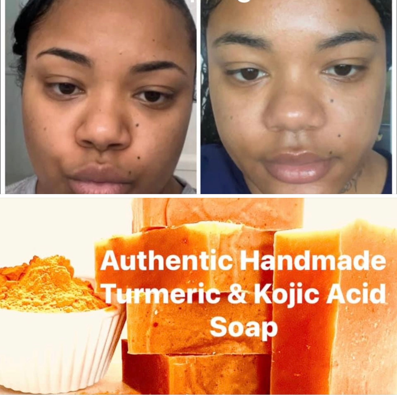 Turmeric Brightening Soaps + Moisturizers