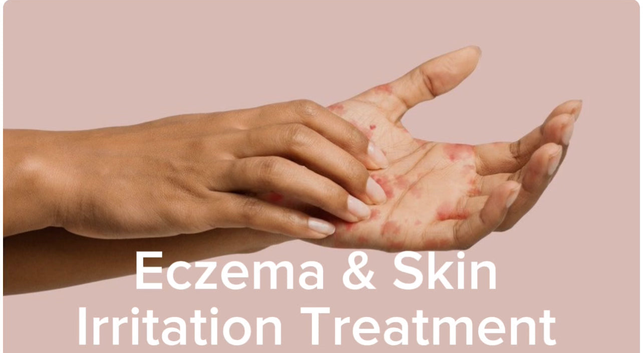 Eczema & Skin Treatments