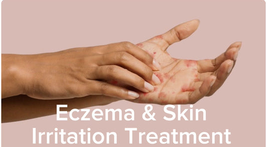 Eczema & Skin Treatments