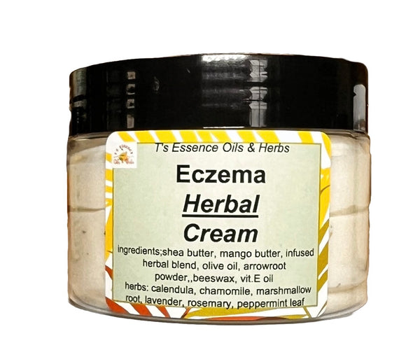 Herbal Skin Relief Cream (Eczema, Skin Rash)